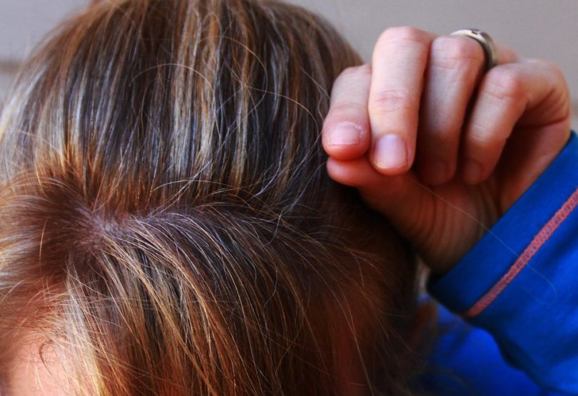 Trápí vás zplihlé vlasy a lupy? Zkuste vlasový peeling